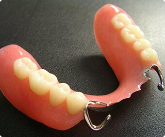 保険適用で作製できる総入れ歯 クラスプ義歯