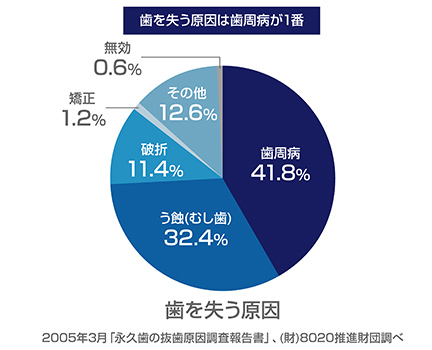 静かに進行する歯周病気づいてからでは治療が間に合わないことも